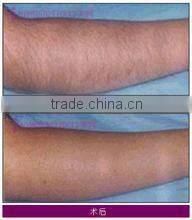 BFP-4000 Professional 3IN1 multi functional IPL machine