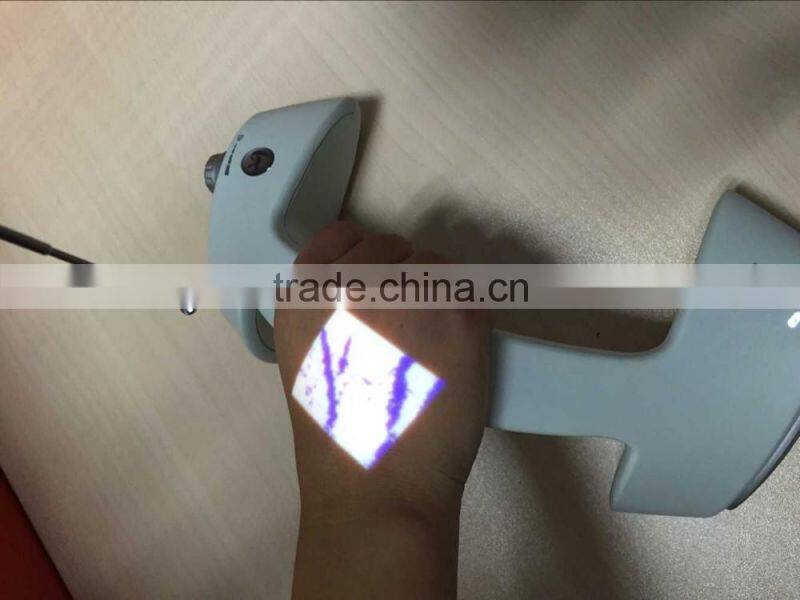 2016 on sale!Small injection portable vein finder/vein viewing system/easy to use