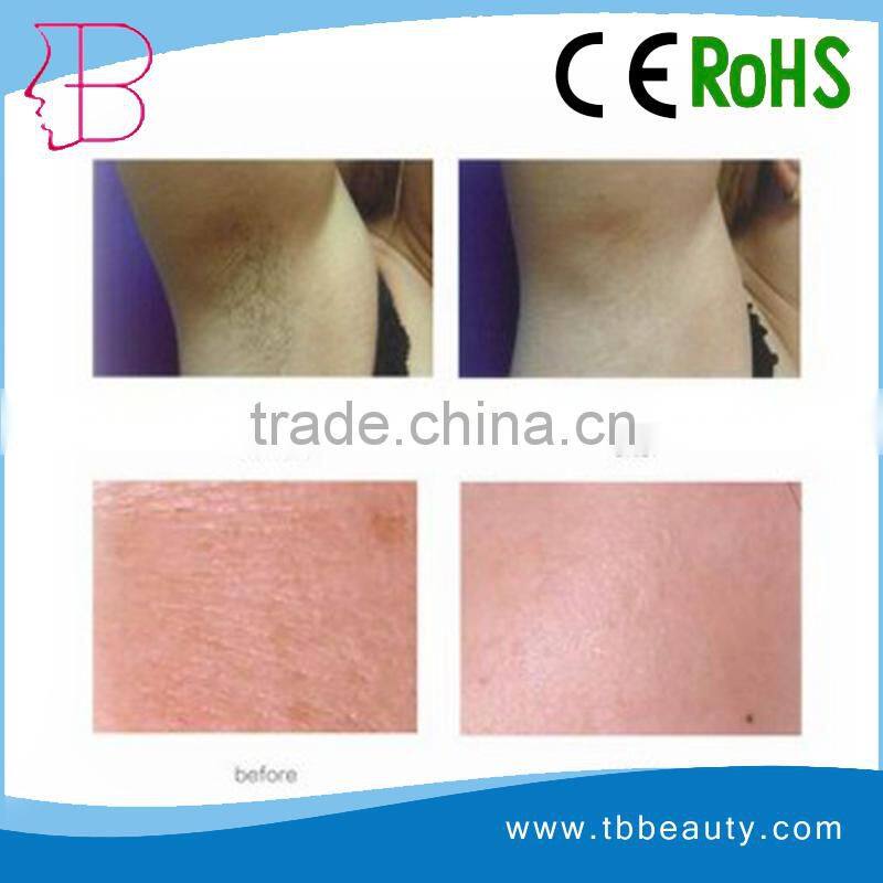 Replaceable filter diode laser for hair removal