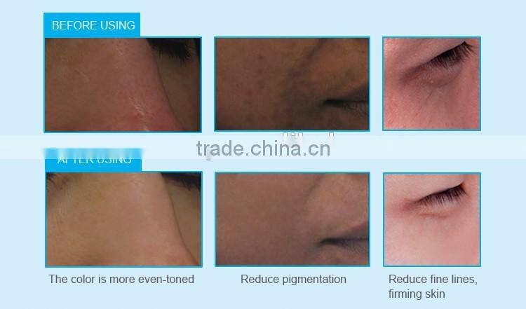 The Firdt Genaration Anion Silicone Facial Massager,Double Side Soft Brush,IXP5waterproof