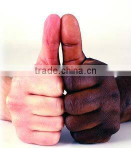 76/132kV (145kV) Porcelain Sleeve Outdoor Termination Sealing End for HV XLPE Cable Accessory of 132kV Cable Terminations