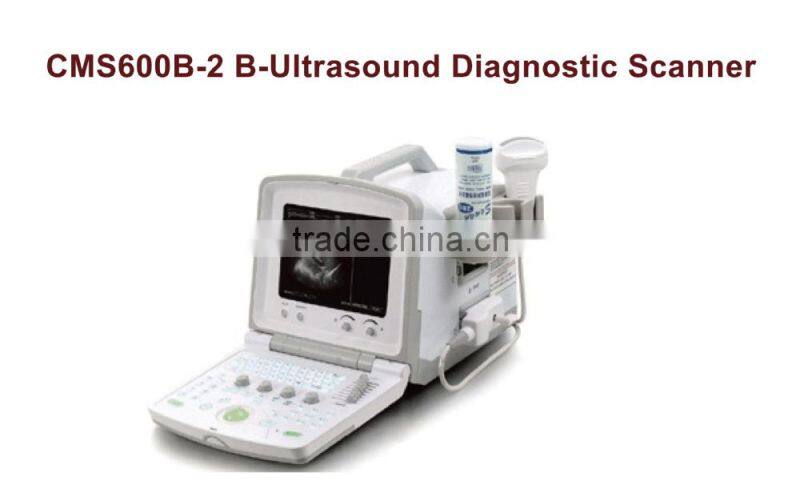 CMS600B-2 Portable scanner machine ultrasound scanner
