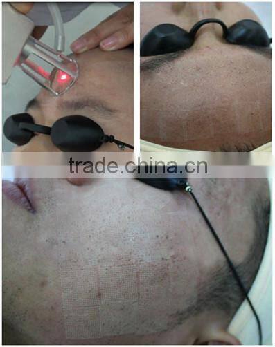 10600nm 40w Carbon dioxide laser skin tightening professional co2 fractional laser equipment