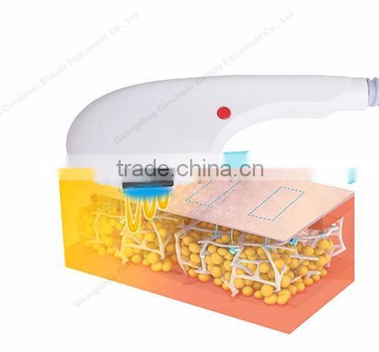 multifunction beauty equipment shr fast elight machine hair removal