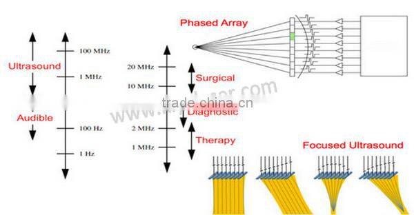 Distributor price hifu for skin tightening