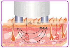 Home use radio frequency treatment