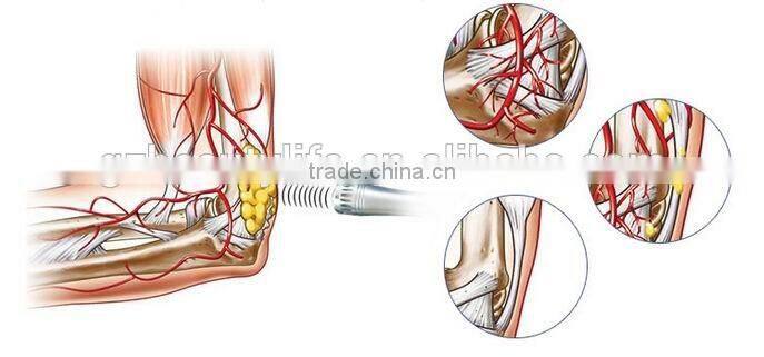 GZBL extracorporeal shock wave therapy equipment sw8 beauty equipment
