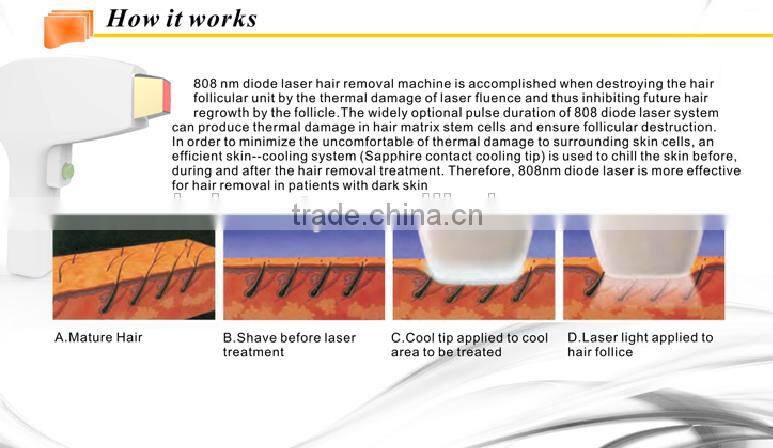 Competitive price new design diode laser 808nm beauty machine of hair removal with good price