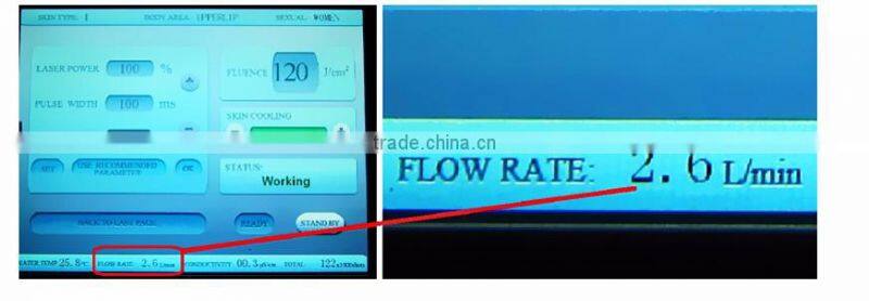 Promotion!!! High Quality Low Price soft light laser hair removal machine permanent hair removal
