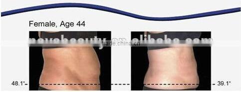 Alibaba China Suppier rf face lift machine photon ultrasonic device cavitation rf machine,New face NV-i3