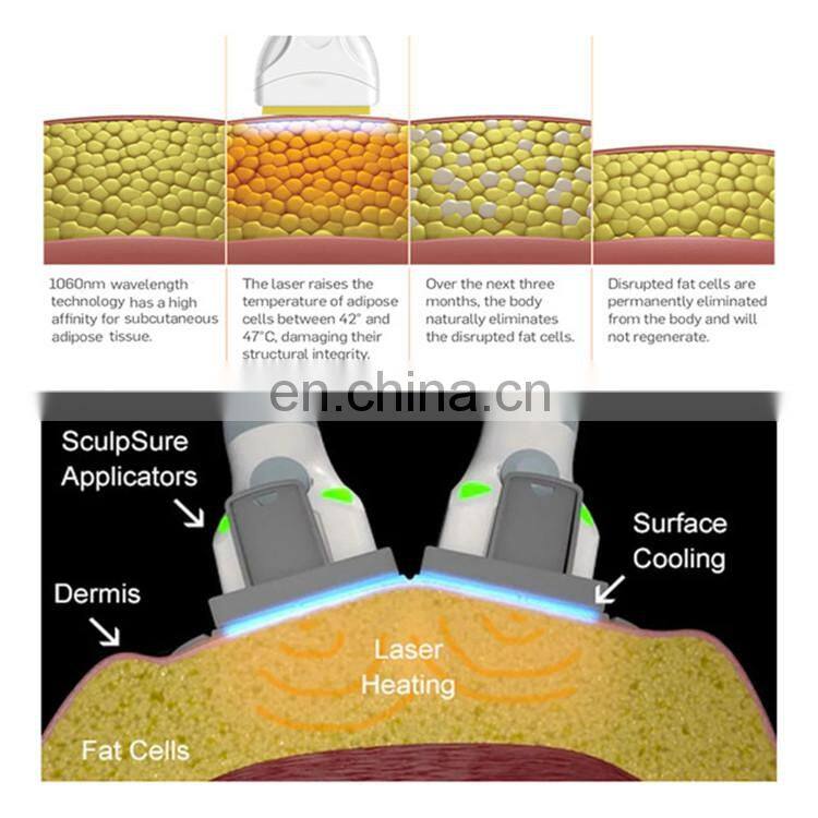 Tendencia 2021 rf fat reduction machine fat reduction remedy fat burning reduction body contouring slim