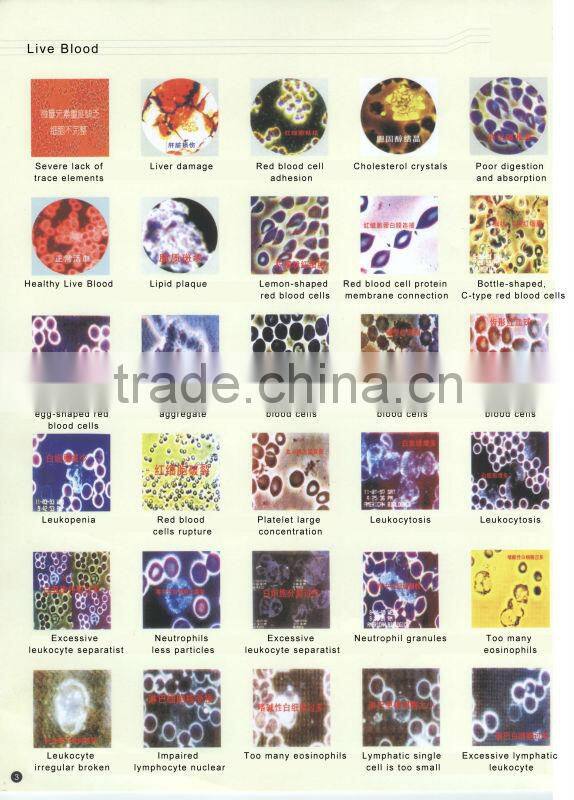 Blood Analyzing Video Microscope in dark Field