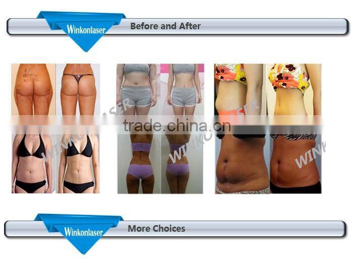 2016 new design! the latest cryolipolysis body slimming and fat reduction machine