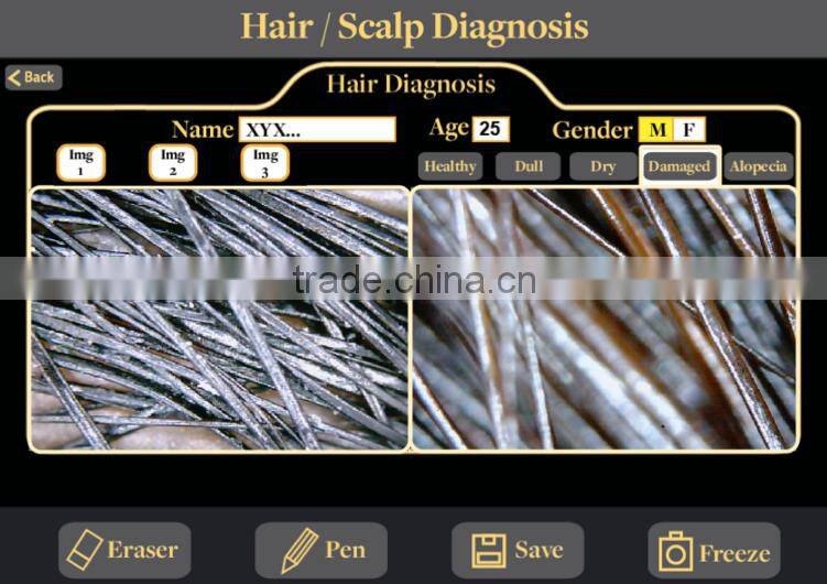 hair analysis machine in Skin Analyzer hair analysis equipment