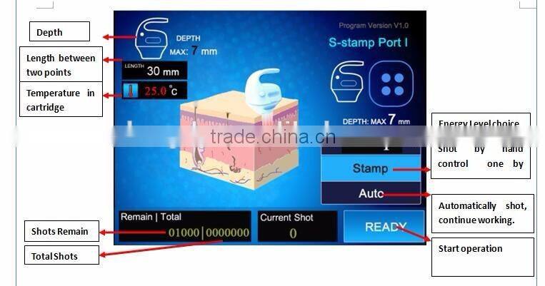 HIFU beauty machine cartridge