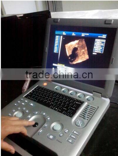 (MSLCU18)3D 4D handheld Color Doppler Medical Ultrasound Scan Machine