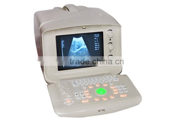 RUS-6000A Best Sale Hospital Clinic Portable Ultrasound Machine/Scanner with convex, transvaginal, linear, rectal probe-Shelly