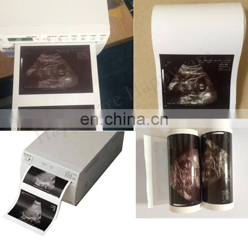 HC-A024 Sony thermal printer for ultrasound /Video printer paper for UPP-110S
