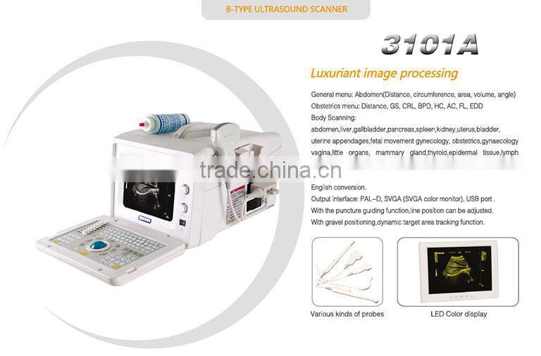 Full digital portable ultrasound scanner