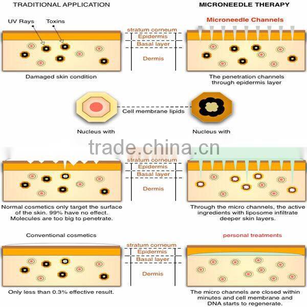 zgts titanium derma roller,ce approved derma rollers,derma microneedle roller