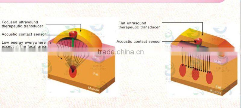 latest bipolar and tripolar radio frequency cavitation slimming beauty Fat Dissolving equipment