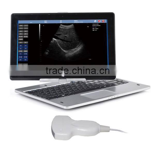 UProbe-20 Probe Type Ultrasound Scanner for laptop