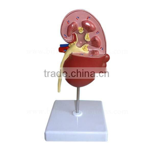 Pathological Medical Human Body Anatomy Model Kidney
