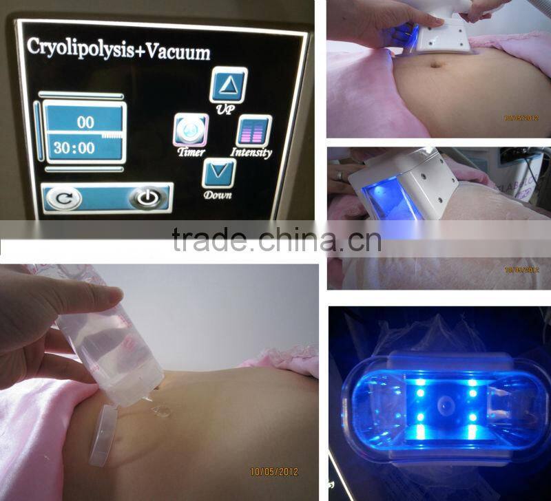 Hotsale 3 in 1 Cryo Slimming Machine with Ultrasonic RF
