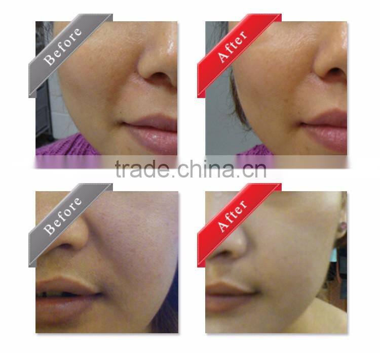 Best Selling Collagen oxygen bubble Facial Mask gel