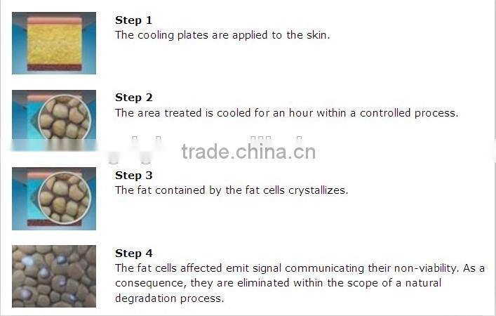 4 Fat Freezing Pads + 2 Cryo Handles Cryolipolysis weight loss product, liposuction cryolipolysi machine