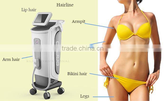 IPL diode laser hair removal machine price diode laser hair removal portable