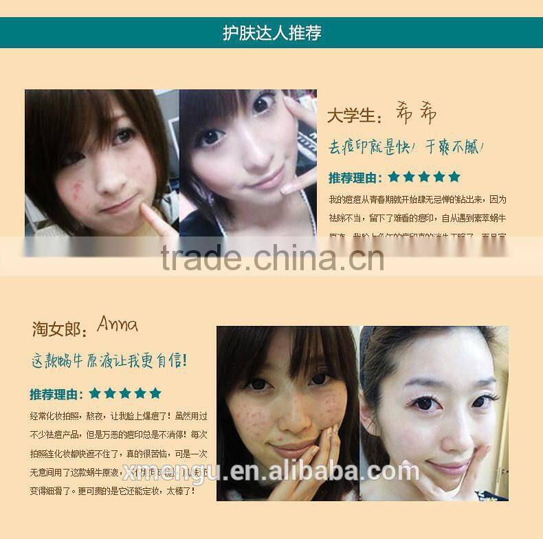 Powerful Snail Repair Serum Solution Moisturizing Remove Acne Marks Scar Skin Cell Regeneration