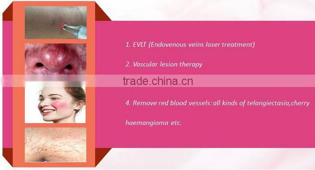 980nm diode laser medical CE HOT! Vascular Vein Removal Machine/ Spider Vein Removal