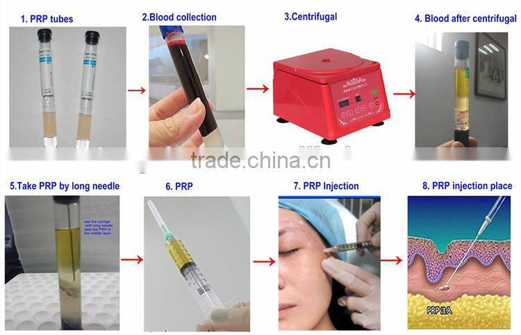 Small size PRP centrifuge DD4-M