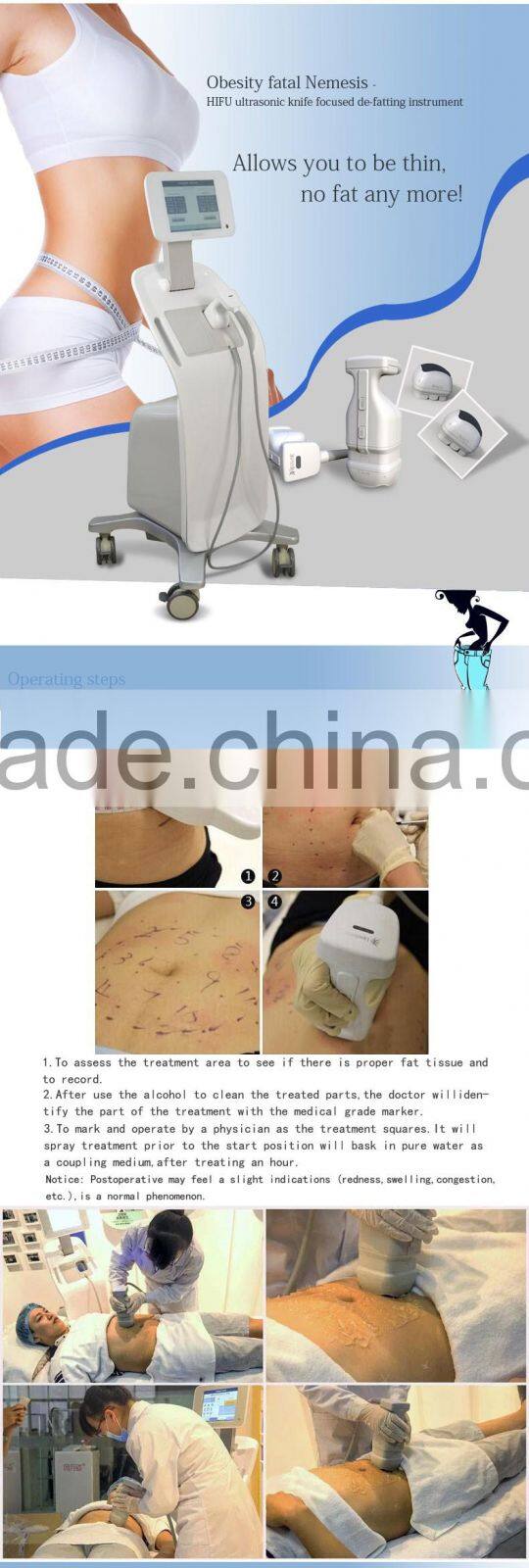 2016 Hot sale lipo hifu slimming machine for weight loss