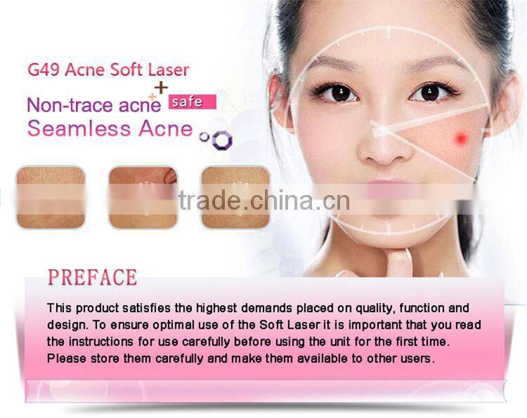 Mini laser acne scar removal device for home used