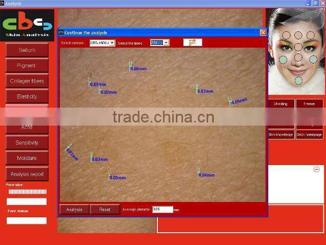 3D analysis skin pigment analyzer