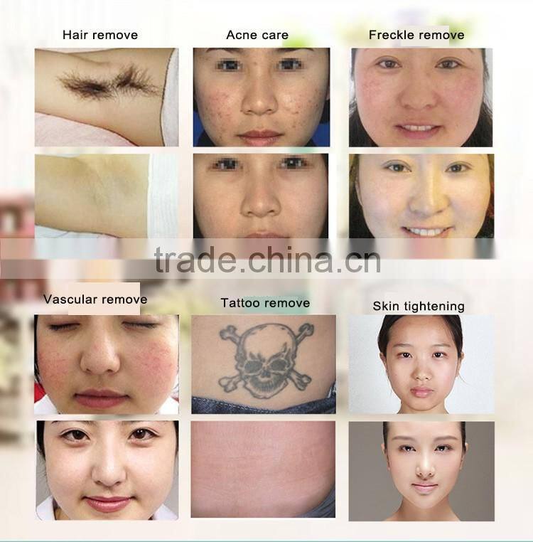 removal epilator Skin Rejuvernation ipl power