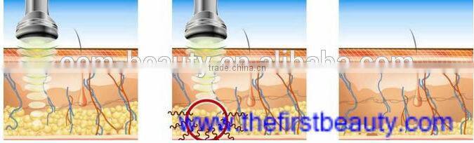Ultrasonic cavitation Cellulite Reduction body slimming beauty equipment