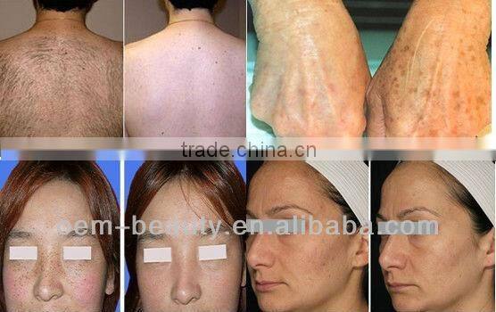 Home and Spa using IPL photofacial machine,IPL hair removal beauty equipment with OEM service -A003