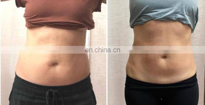 High quality electrical muscle stimulation device electromagnetic tesla hip trainer physiotherapy muscle stimulator