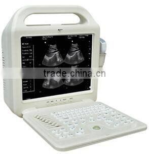 2016 LCD Display Ultrasound Scanner with Convex Probe