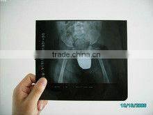 kodak film wholesale,x-ray mobile,tone tube