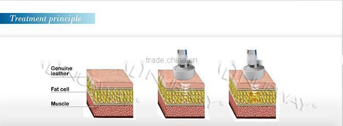 World most advanced latest HIFUSHAPE hifu transducer for body slimming body shaping weight loss