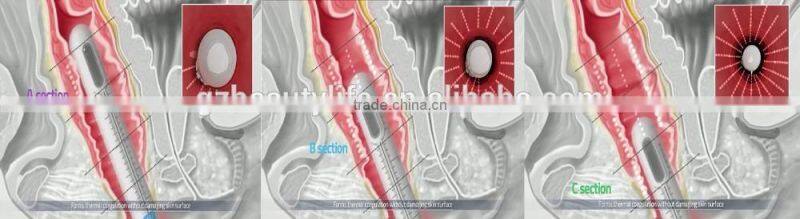 private tighten hifu system