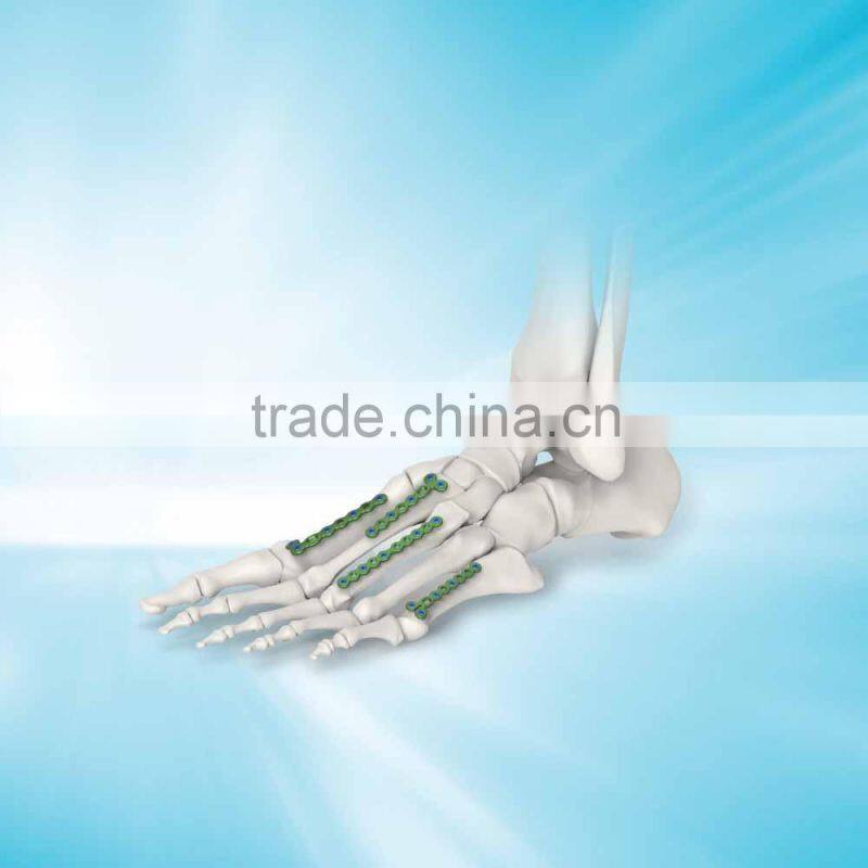 Fully stocked surgical operation implants hospital surgical plates and screws, orthopaedic plates,medical device,2.5 L type LCP