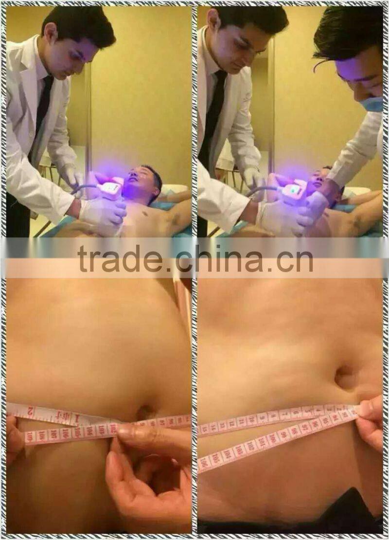 LS08-laura HOT sale Ultrashape / Liposonix / HIFU Slimming Machine