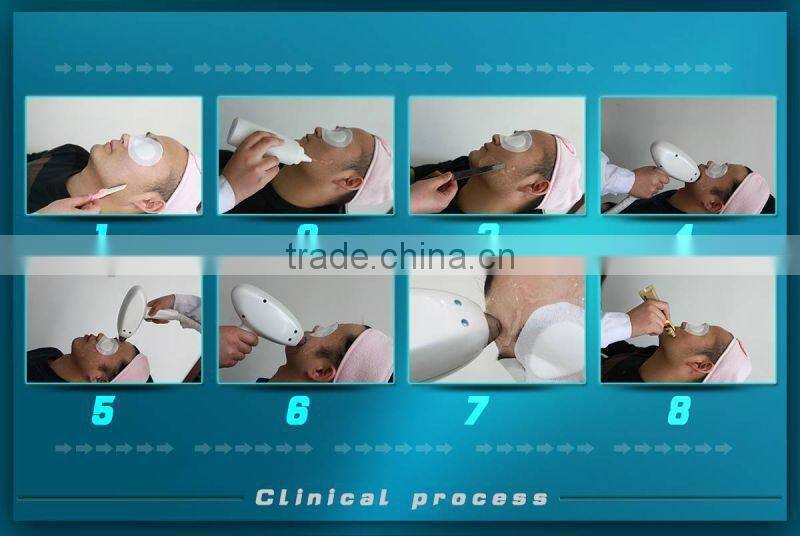 Best laser hair removal equipment for any skin color