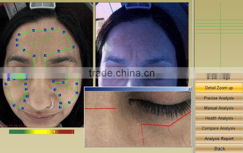 visia skin analysis portable machine with high pixel