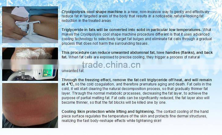 2016 Best weight loss machine Cryolipolysis Fat Freezing Machine Price For Sale